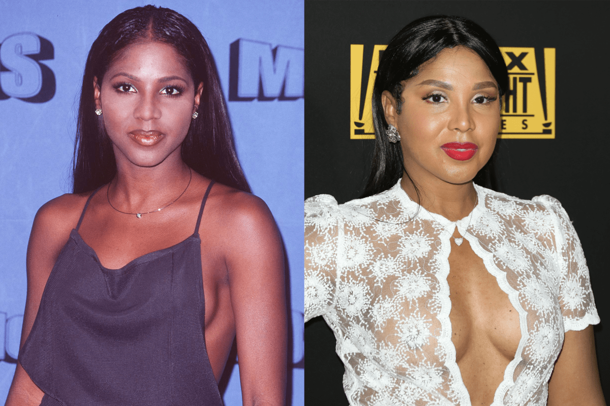 Toni Braxton Plastic Surgery